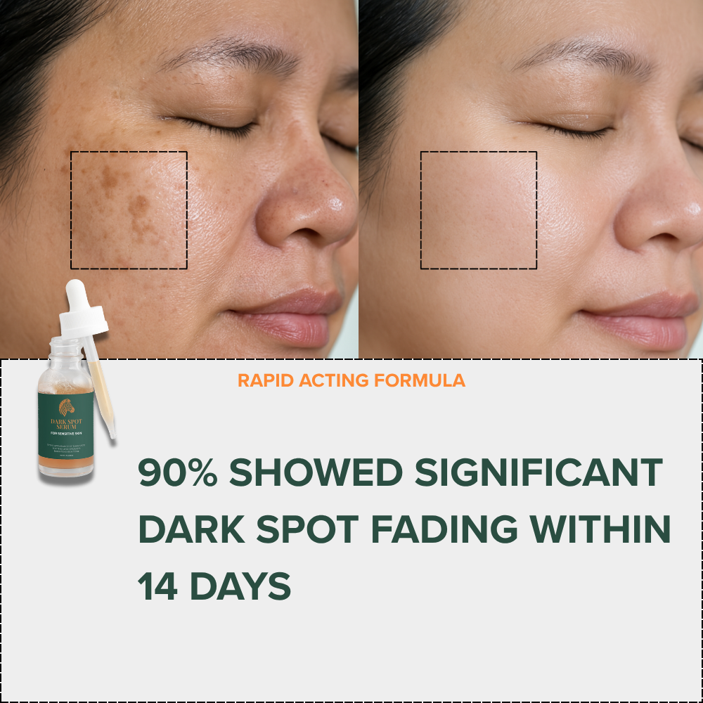 Rapid Dark Spot Remover Serum