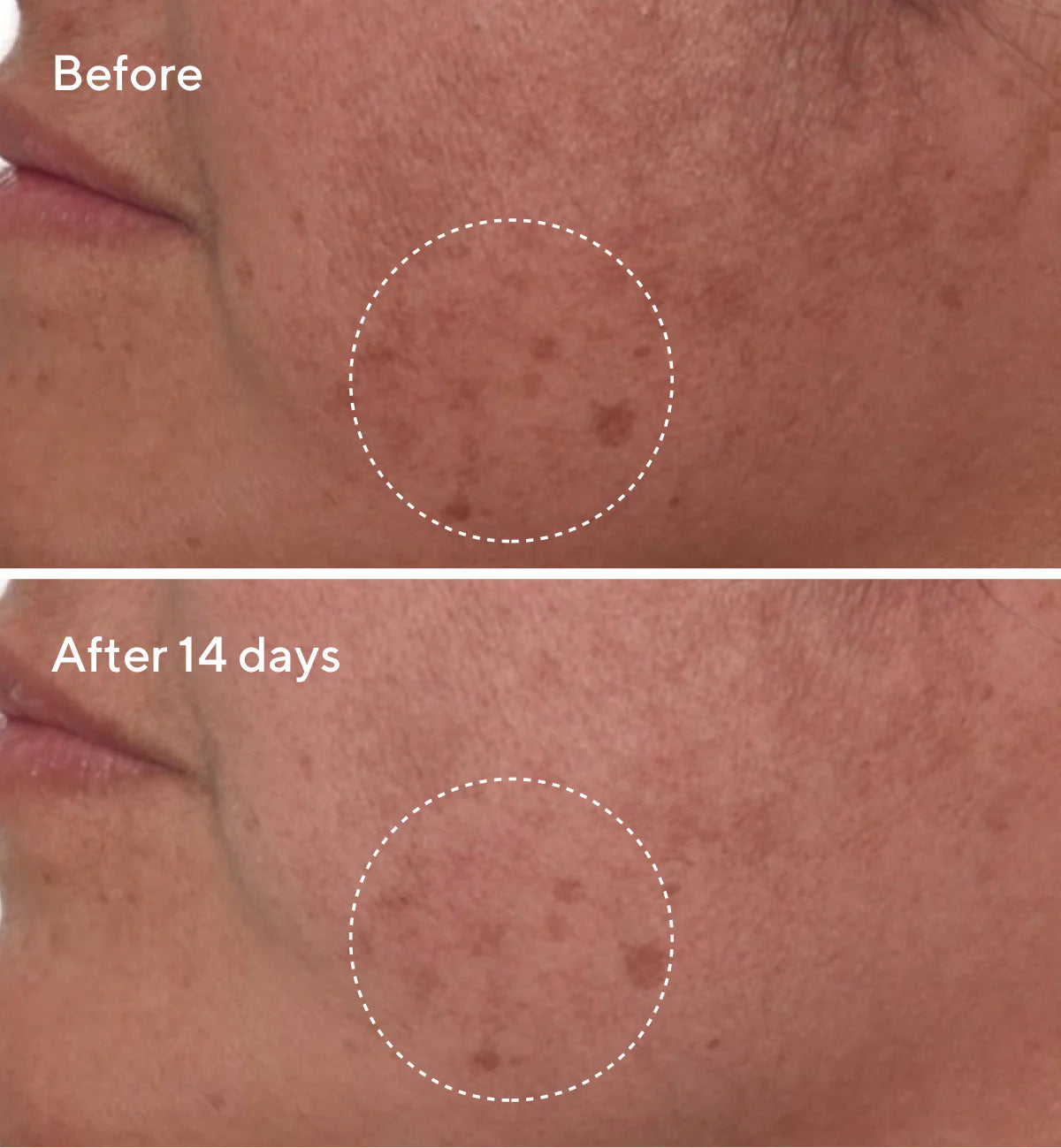 Rapid Dark Spot Remover Serum