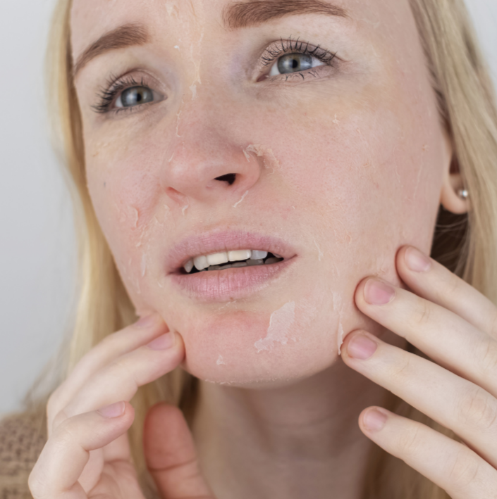 woman with dry face skin