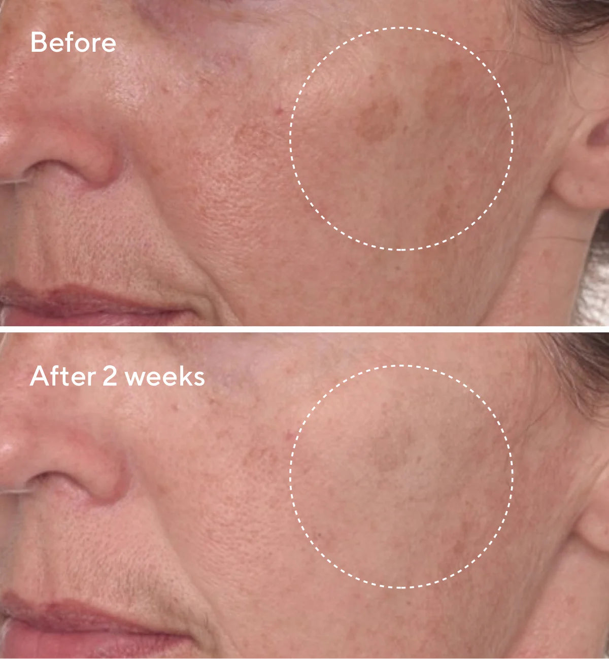 Rapid Dark Spot Remover Serum