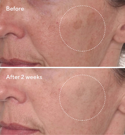 Rapid Dark Spot Remover Serum